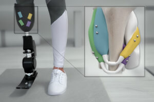 Prosthetic-Devices