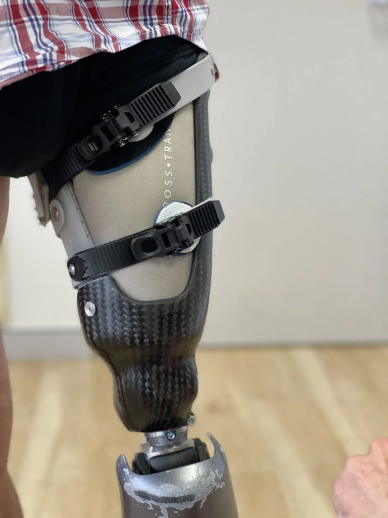 Unique​ Microprocessor-Controlled Knee & Foot Prosthetics
