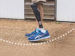 Microprocessor Knees
